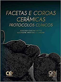 Facetas E Coroas Cerâmicas: Protocolos Clínicos