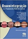 Osseointegração E O Tratamento Multidisciplinar