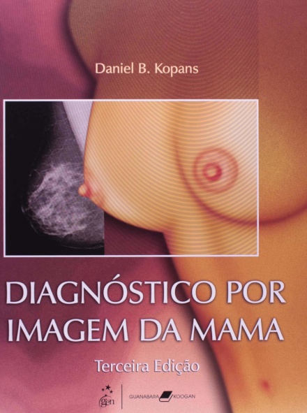 Diagnóstico Por Imagem Da Mama