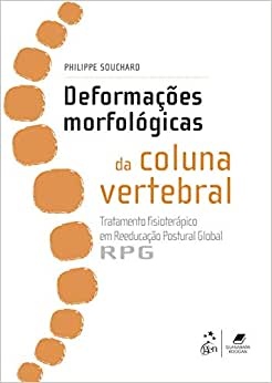 Deformações Morfológicas Da Coluna Vertebral