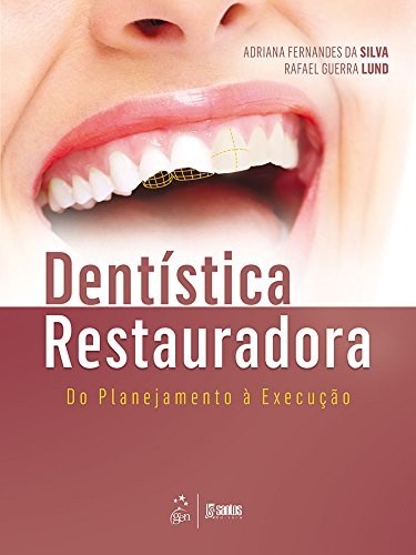 Dentística Restauradora Do Planejamento À Execução