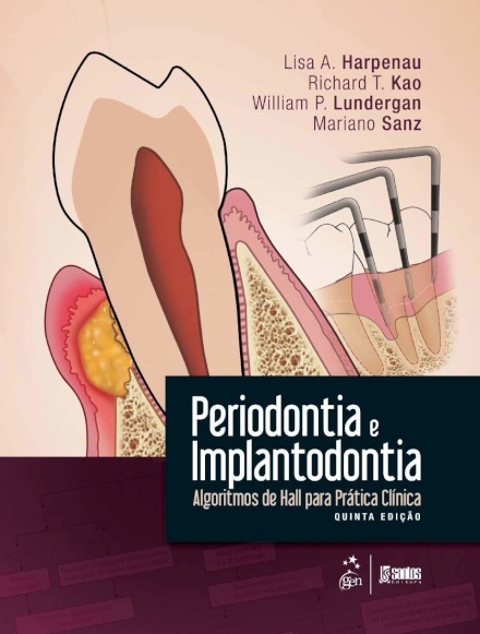 Periodontia e Implantodontia Algoritmos de Hall para Prática Clínica