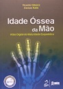 Idade Óssea Da Mão