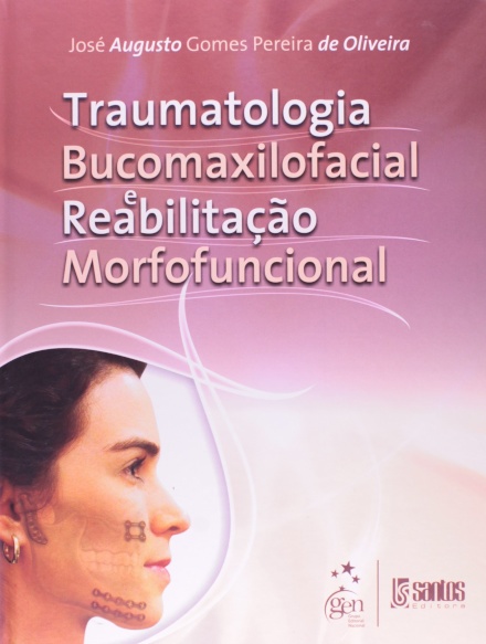 Traumatologia Bucomaxilofacial E Reabilita Morfofuncional