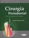 Cirurgia Estética Periodontal