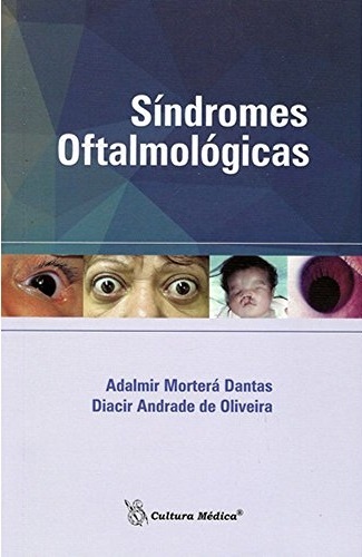 Síndromes Oftalmológicas