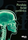 Paralisia Facial Periferica