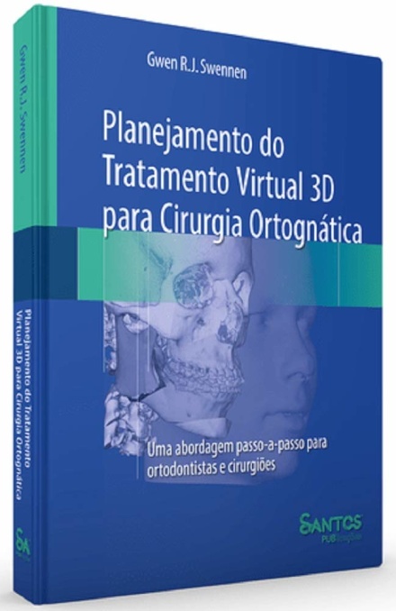 Planejamento Do Tratamen Virtual 3D Cirurgia Ortognática