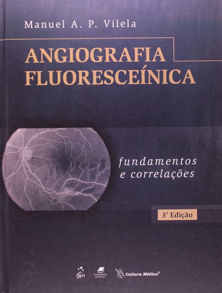 Angiografia Fluoresceínica Fundamentos E Correlações