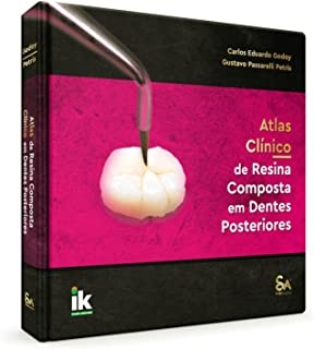 Atlas Clínico De Resina Composta Em Dentes Posteriores