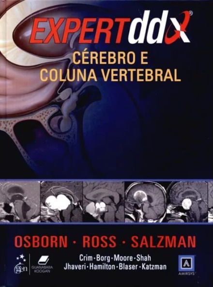 Expert Ddx Cérebro E Coluna Vertebral