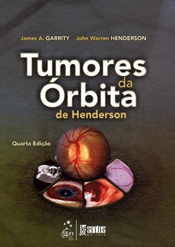 Tumores Da Órbirta De Henderson