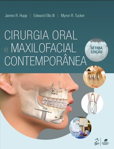 Cirurgia Oral E Maxilofacial Contemporânea