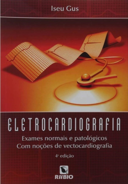 Eletrocardiografia: Exames Normais e Patologicos com Nocoes de Vectocardiografia