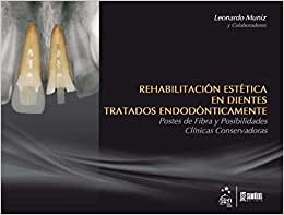 Rehabilitación Estética En Dientes Tratados Endodónt