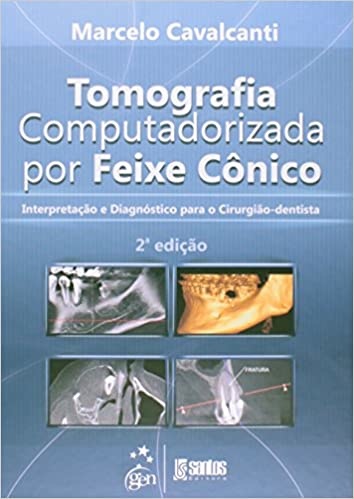 Tomografia Computadorizada Por Feixe Cônico Dentista