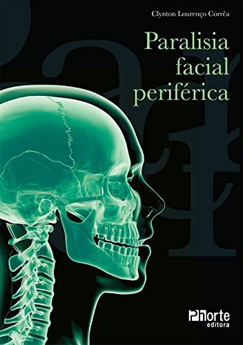 Paralisia Facial Periferica