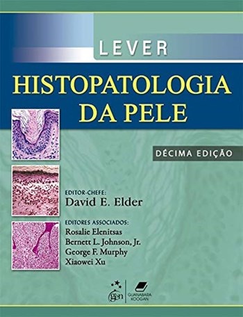 Lever Histopatologia Da Pele