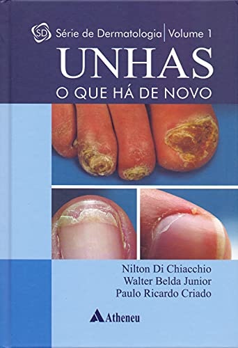 Unhas. O Que Há De Novo - Volume 1