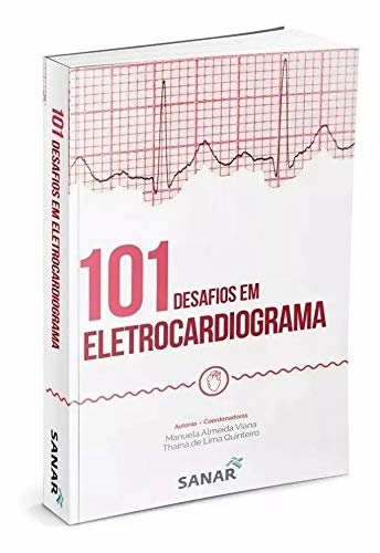 101 desafios em eletrocardiograma