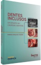 Dentes Inclusos: Um Desafio Ao Cirurgião-Dentista