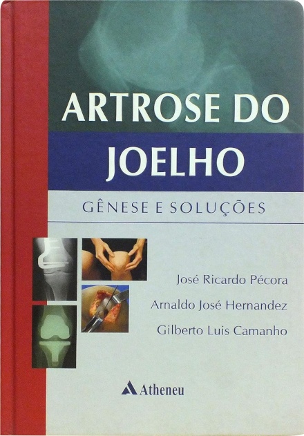 Artrose Do Joelho. Gênese E Soluções