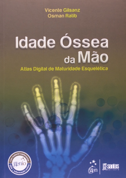 Idade Óssea Da Mão