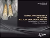 Rehabilitación Estética En Dientes Tratados Endodónt