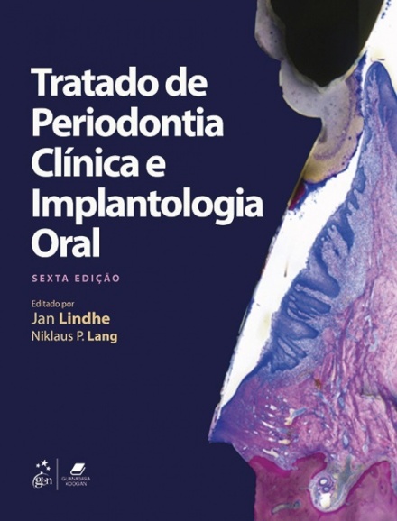 Tratado De Periodontia Clínica E Implantologia Oral