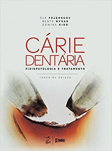 Cárie Dentária Fisiopatologia E Tratamento