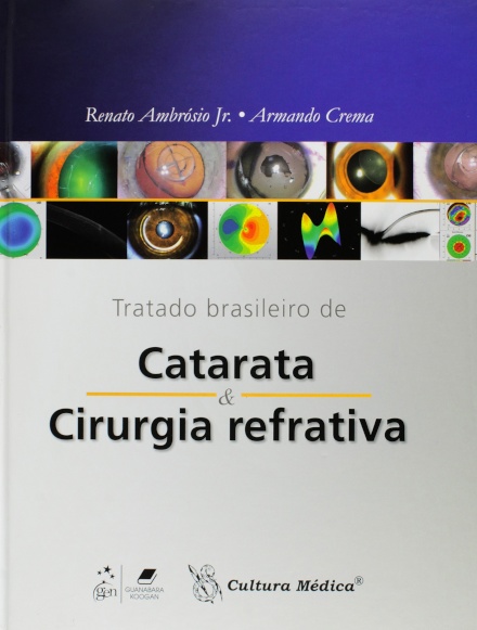 Tratado Brasileiro De Catarata E Cirurgia Refrativa