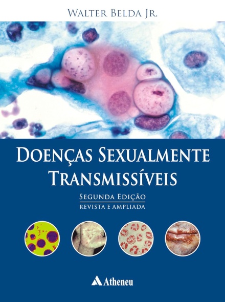 Doenças Sexualmente Transmissíveis