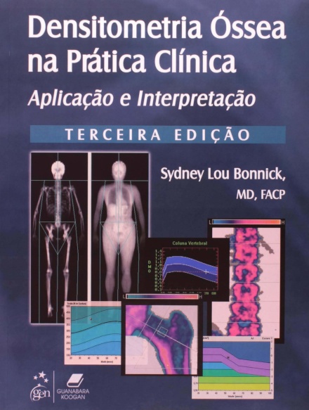 Densitometria Óssea na Prática Clínica - Aplicação e Interpretação