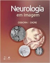 Neurologia Em Imagem