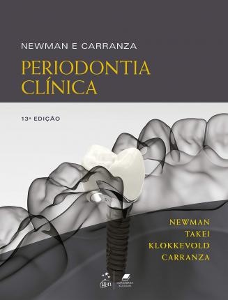 Newman E Carranza Periodontia Clínica