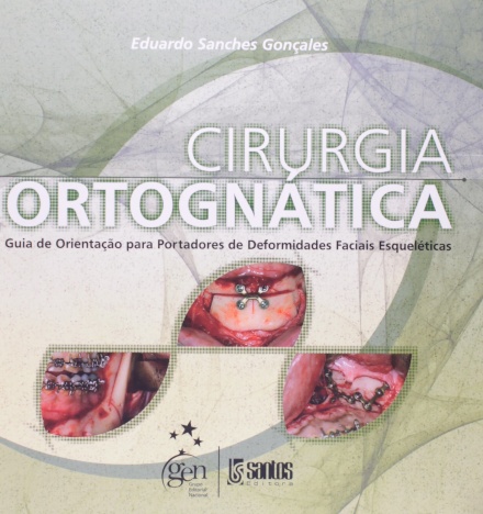 Cirurgia Ortognática - Guia de Orientação para Portadores de Deformidades Faciais Esqueléticas