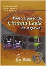 Passo A Passo Da Cirurgia Lasik De Agarwal