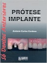 Prótese Sobre Implante Só Dentes Anteriores