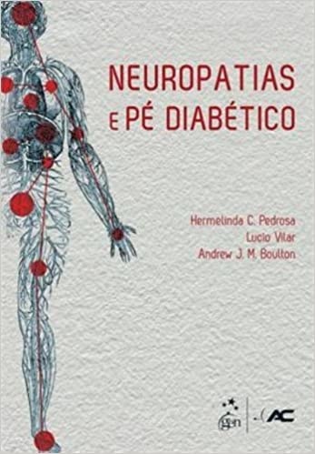 Neuropatias E Pé Diabético