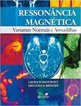 Ressonância Magnética Variantes Normais E Armadilhas