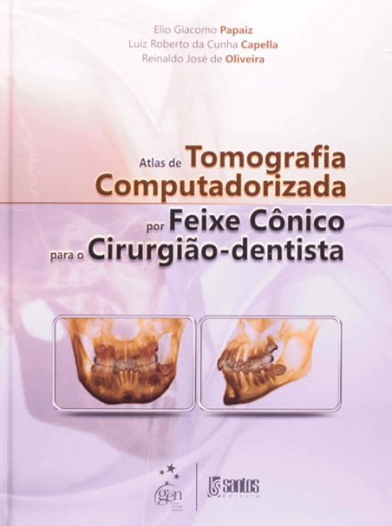 Atlas De Tomografia Computadorizada Por Feixe Cônico