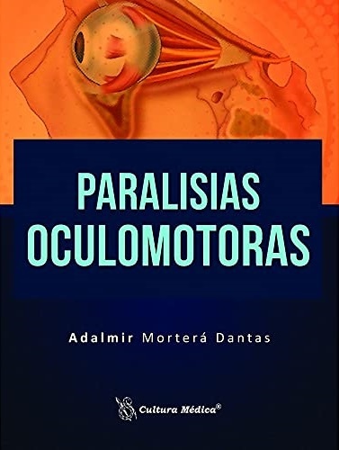 Paralisias Oculomotoras