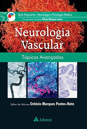 Neurologia Vascular