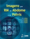 Imagens Por Ressonância Magnética Do Abdome E Pélvis