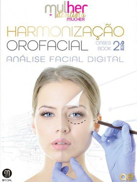 Harmonização Orofacial 2: Análise Facial Digital Mdm