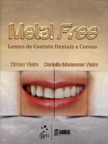 Metal Free: Lentes De Contato Dentais E Coroas