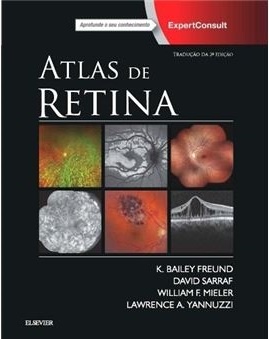 Atlas De Retina