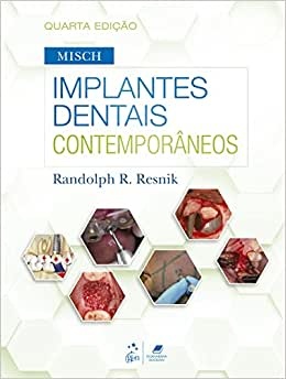 Implantes Dentais Contemporâneos