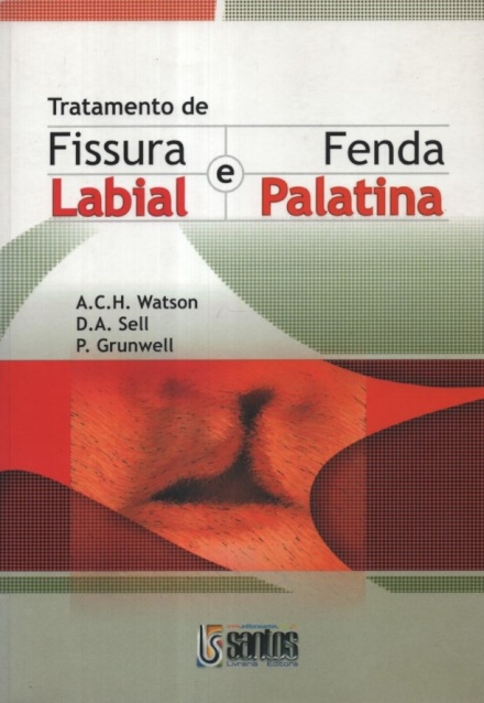 Tratamento De Fissura Labial E Fenda Palatina