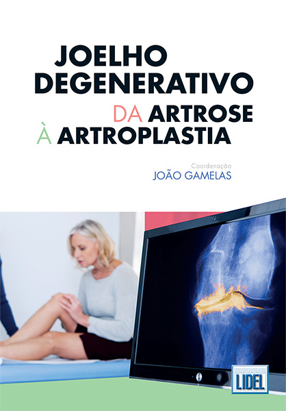 Joelho Degenerativo: Da Artrose à Artroplastia